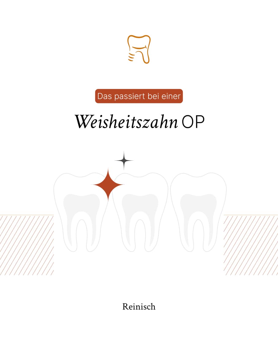 Grafik mit dem Titel: Das passiert bei einer Weisheitszahn OP.